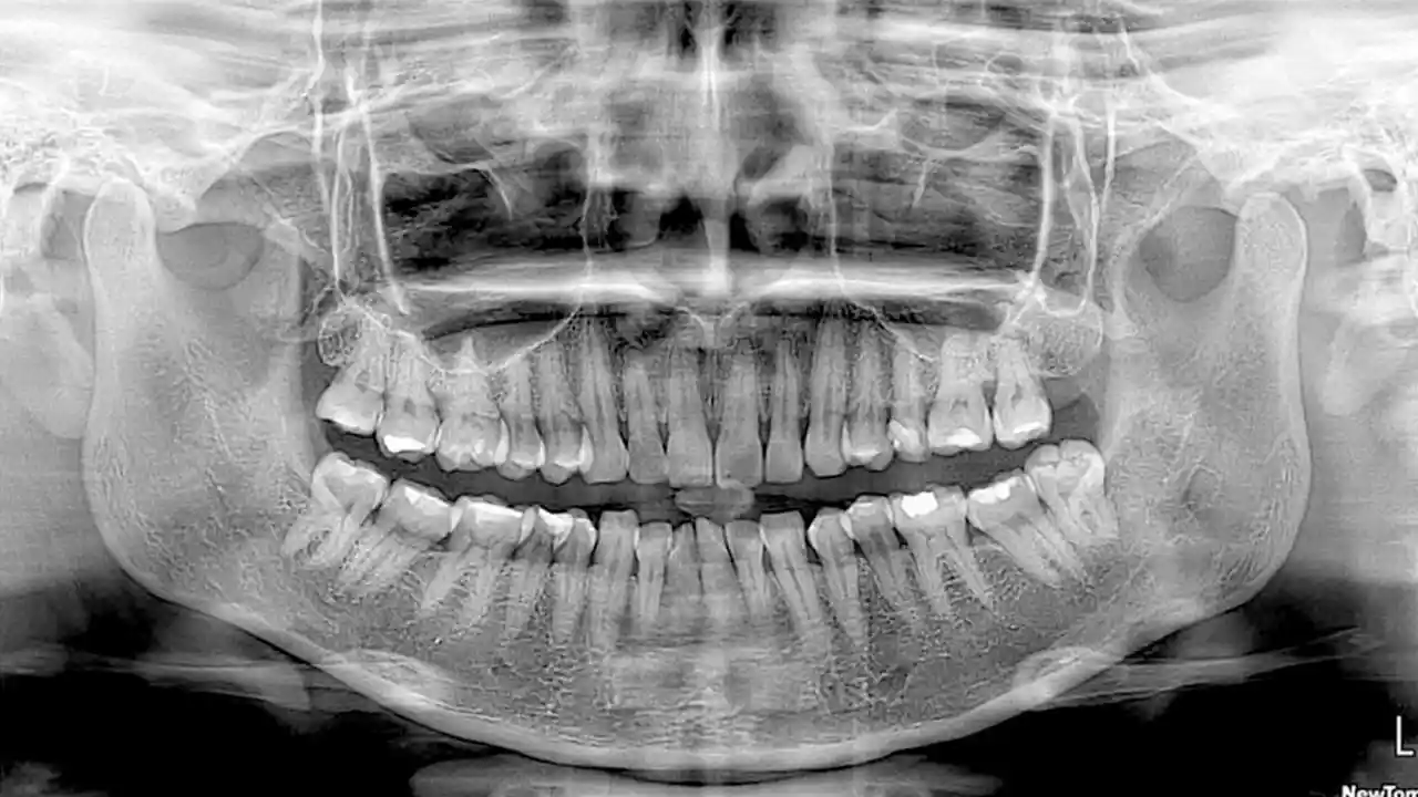 Radiografía dental panorámica digital