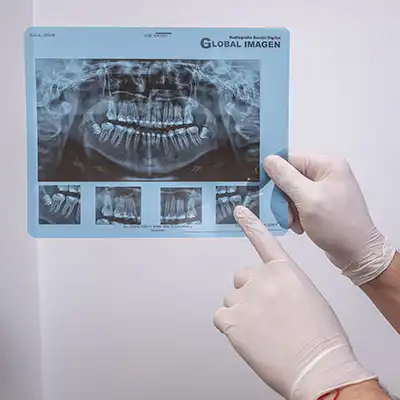 Radiografía dental panorámica digital
